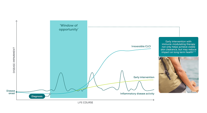 Windown of opportunity